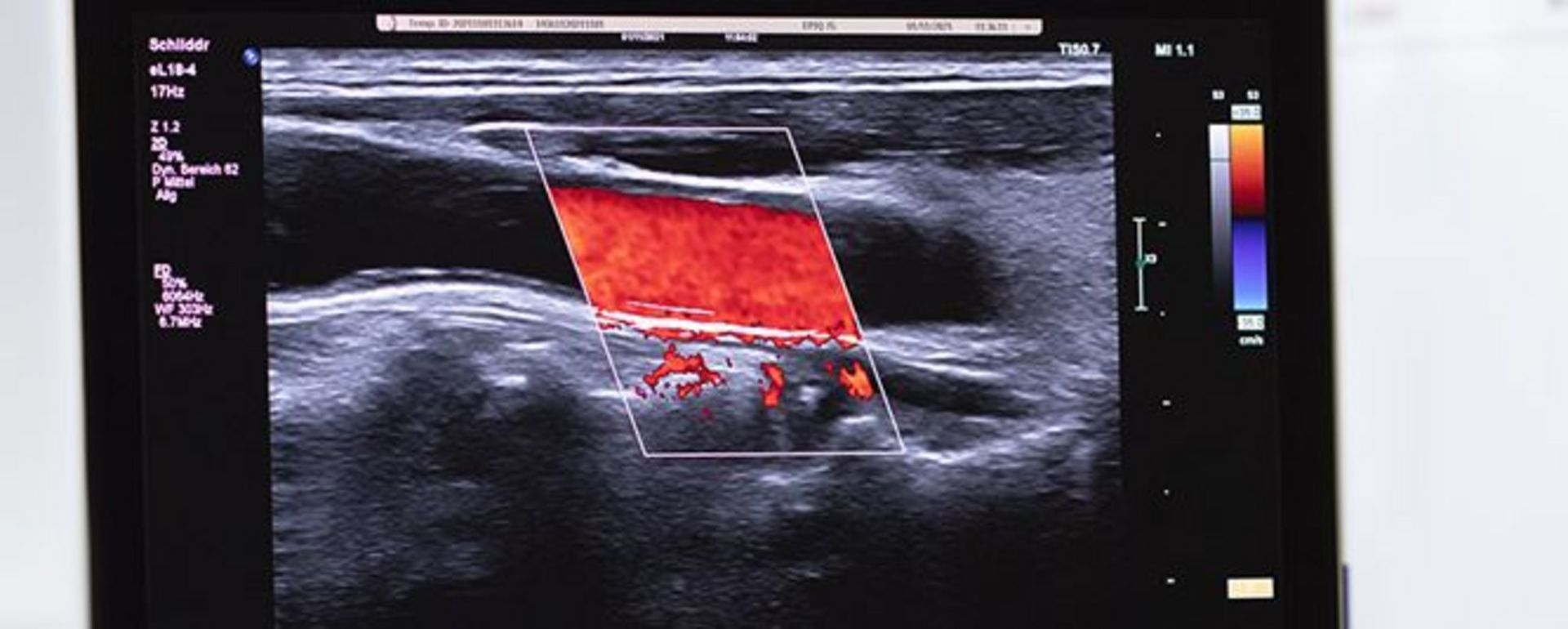 Studienschwerpunkt Medizintechnik im Master Elektrotechnik und Informationstechnik (© RUB/MT)