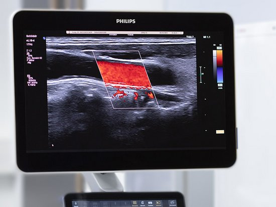 Studienschwerpunkt Medizintechnik im Master Elektrotechnik und Informationstechnik (© RUB/MT)