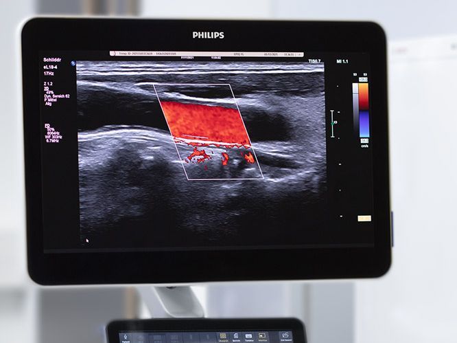 Studienschwerpunkt Medizintechnik im Master Elektrotechnik und Informationstechnik (© RUB/MT)