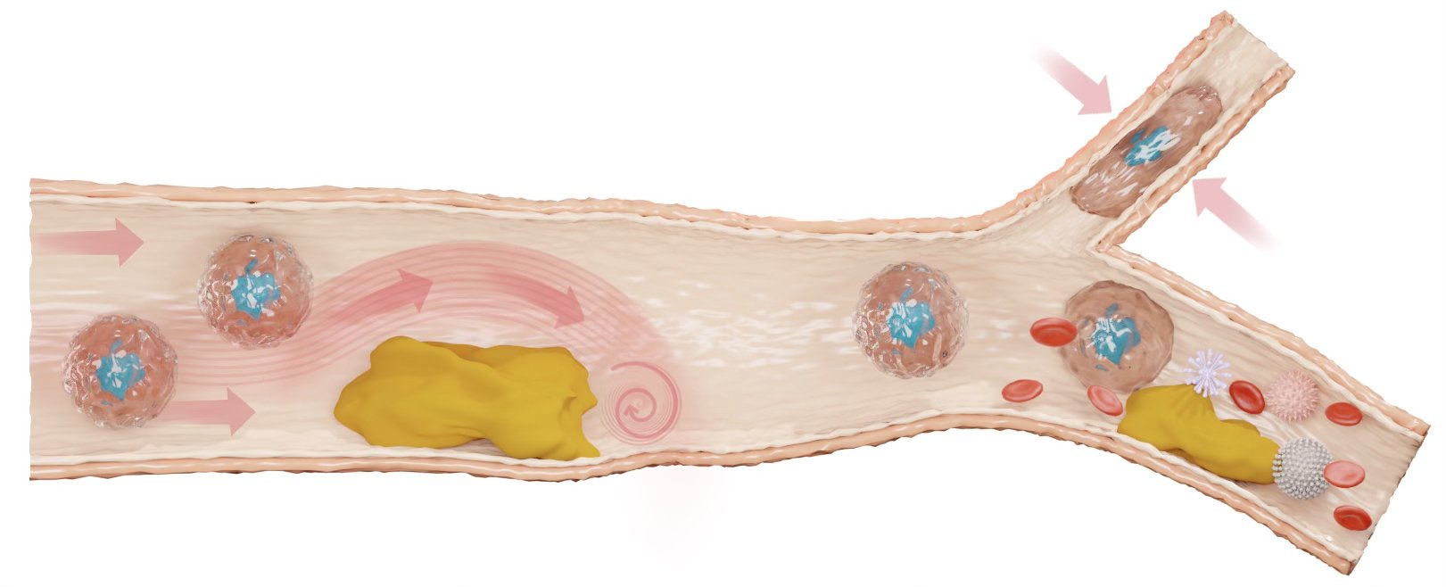 Illustration of the diverse and often unpredictable phenomena that cells encounter while circulating through the circulatory system. This includes a range of fluid dynamics, from smooth laminar flow to chaotic turbulent flow, passage through narrow and constricted vessels, interactions with plaques and vessel irregularities, and the dense, crowded environment created by surrounding blood cells, platelets, and other suspended components within the bloodstream.